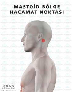 mastoid bölge hacamat noktası